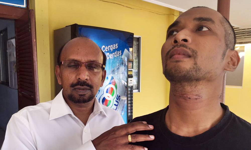 Man claims brutally beaten by police, woke up with over 50 stitches