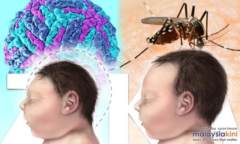 Thailand Confirms Two Cases Of Zika Linked Microcephaly