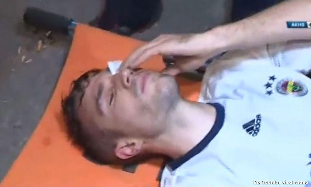 Van Persie mungkin buta
