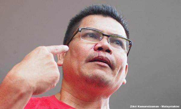 Darah Jamal Tumpah Di Ampang