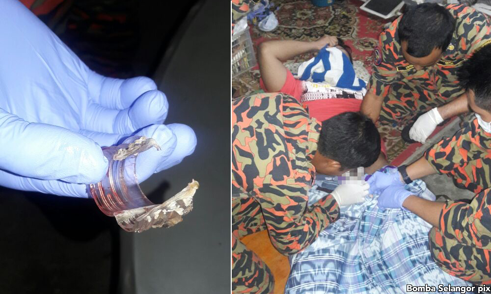 Bomba bantu kes 'anu' dalam botol