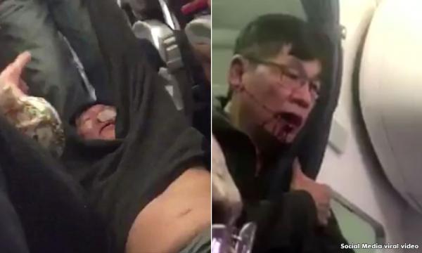 Just Kill Me,' Said Asian Doctor, Bleeding, After Being Dragged Off United  Airlines Plane