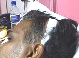 bn mat rempit injured victim 250208 pain