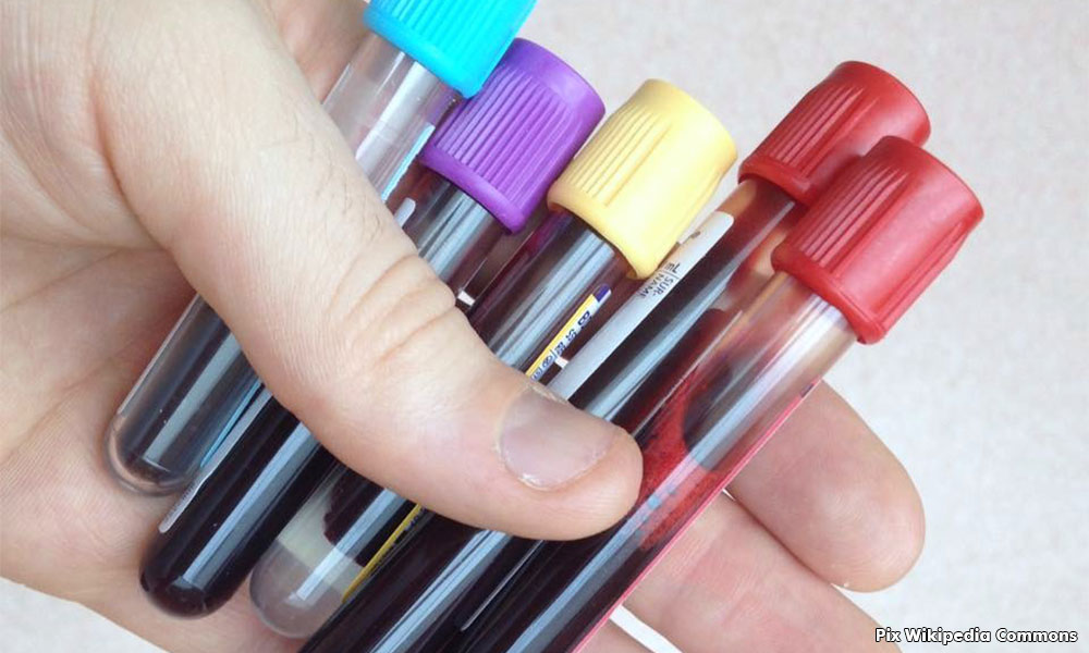 Ministry testing if antibody-rich plasma can help treat Covid-19 patients