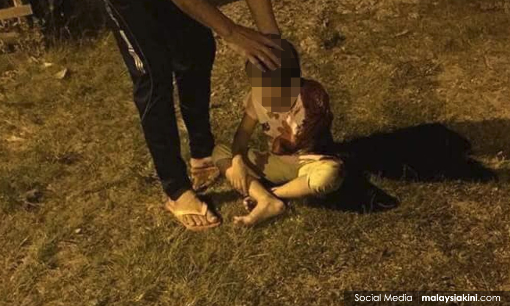 Girl loses arm after jacket stuck in motorcycle tyre