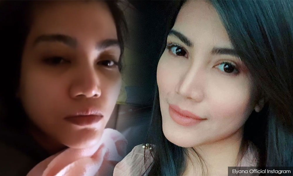 Elyana berdepan risiko lumpuh