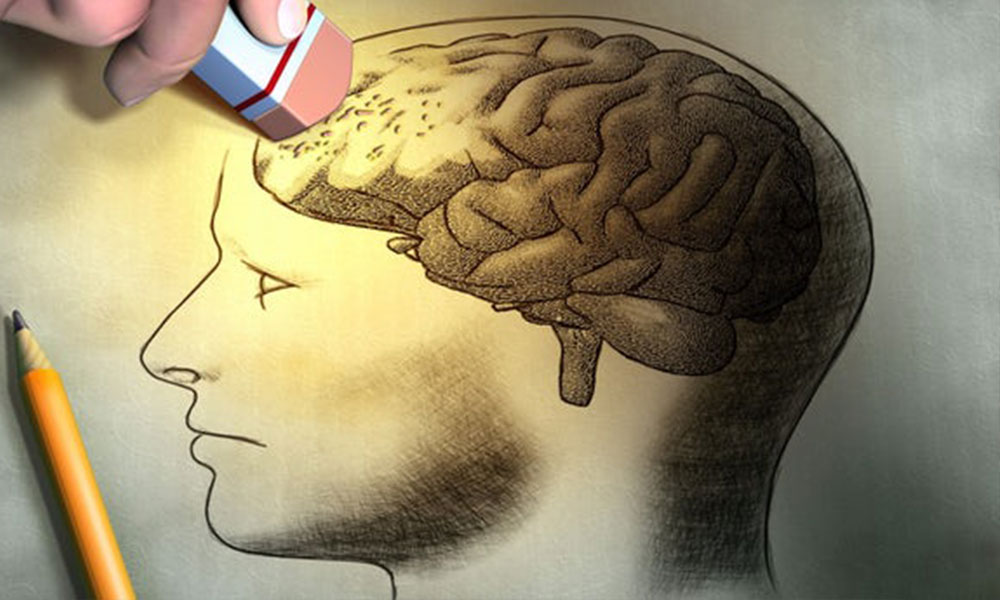 Pesakit alzheimer perlu penjagaan rapi
