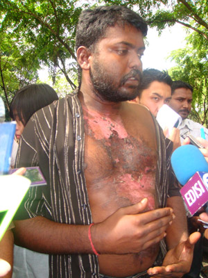 man-tortured-at-brickfields-police-station-prabakar
