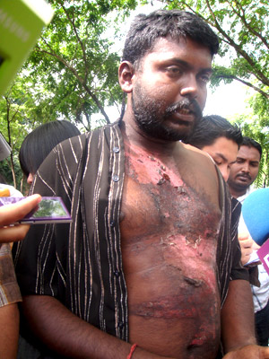 man-tortured-at-brickfields-police-station-311208-b-prabakar-01
