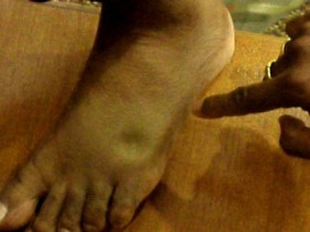 uthayakumar_toe_06022009