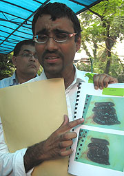 kugan parents mmc 130309 surendran showing spleen
