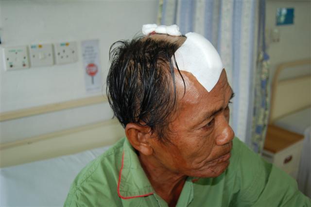 jara&rsquo;ee mathor attacked by thugs 210309 injuries 03