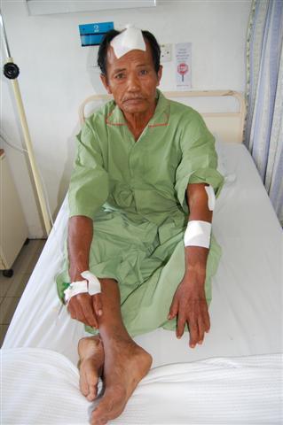 jara&rsquo;ee mathor attacked by thugs 210309 injuries 02