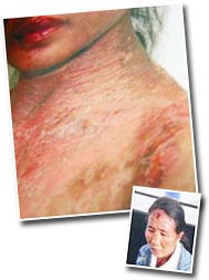 siti hajar indonesian tortured abused maid 190609