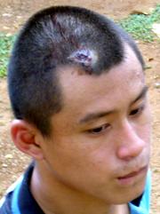 national service cini camp trainees negligence complaint 010709 04