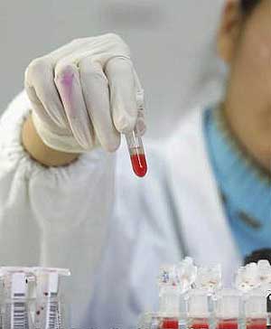 blood test 290609 02