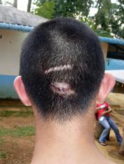 national service cini camp trainees negligence complaint 010709 02