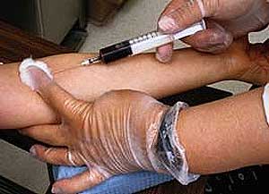 blood test 290609 01