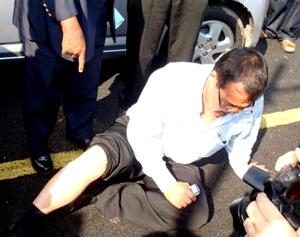 wong chuan how injured 140809 02