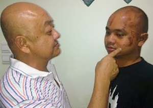Ben cheah ping xen & father assault in sabah
