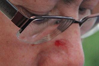 sinchew ipoh reporter injured 181211 01
