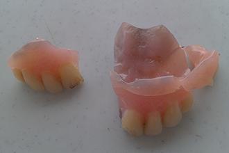 selangor rawang businessman khoo gin seong assaulted by police 210112 broken dentures