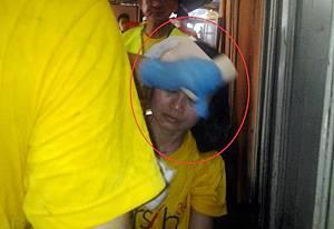 bersih mother group member hurt 3