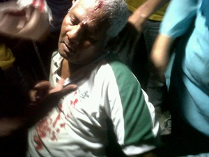 man hit by stone in umno counter rally against pkr ceramah lembah pantai