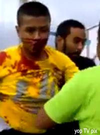 clash in dun sungai rapat 040513 wounded man