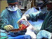 human organ transplant 160307 operation removal of organ