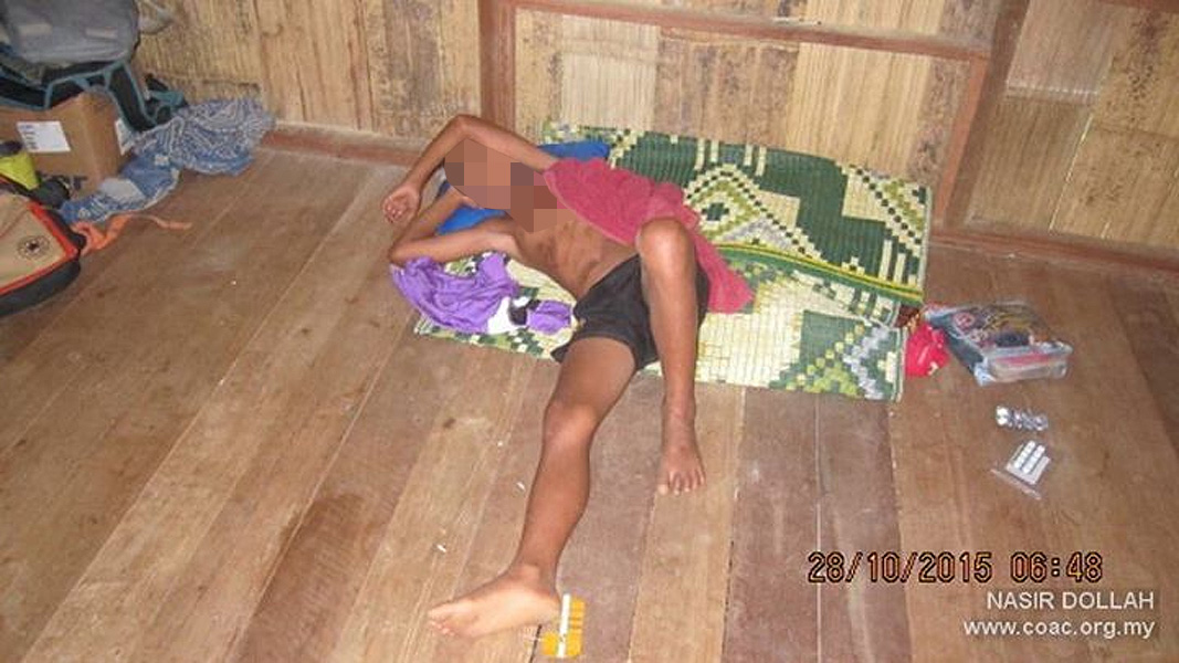 Warga emas Orang Asli meninggal, dipercayai akibat sungai tercemar