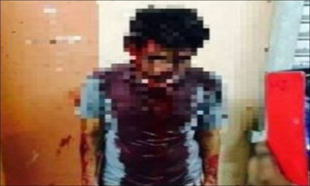 Police nab rape suspect beaten up by public